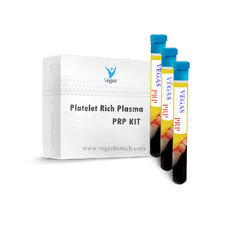 PRP Tube